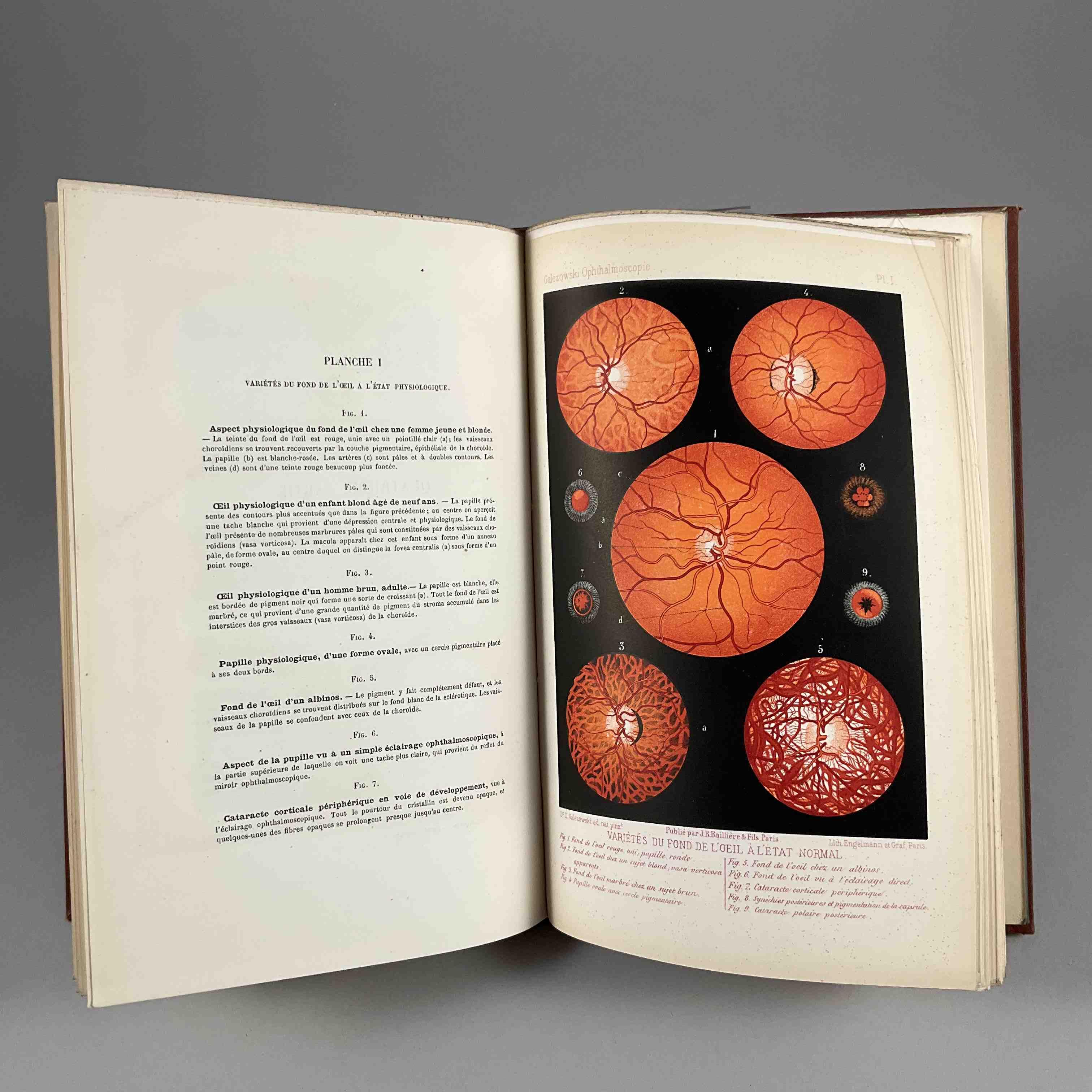 [Ophtalmologie] X Galezowski, Traité iconographique d ophthalmoscopie.
Paris, Baillière, 1876. In-8,...